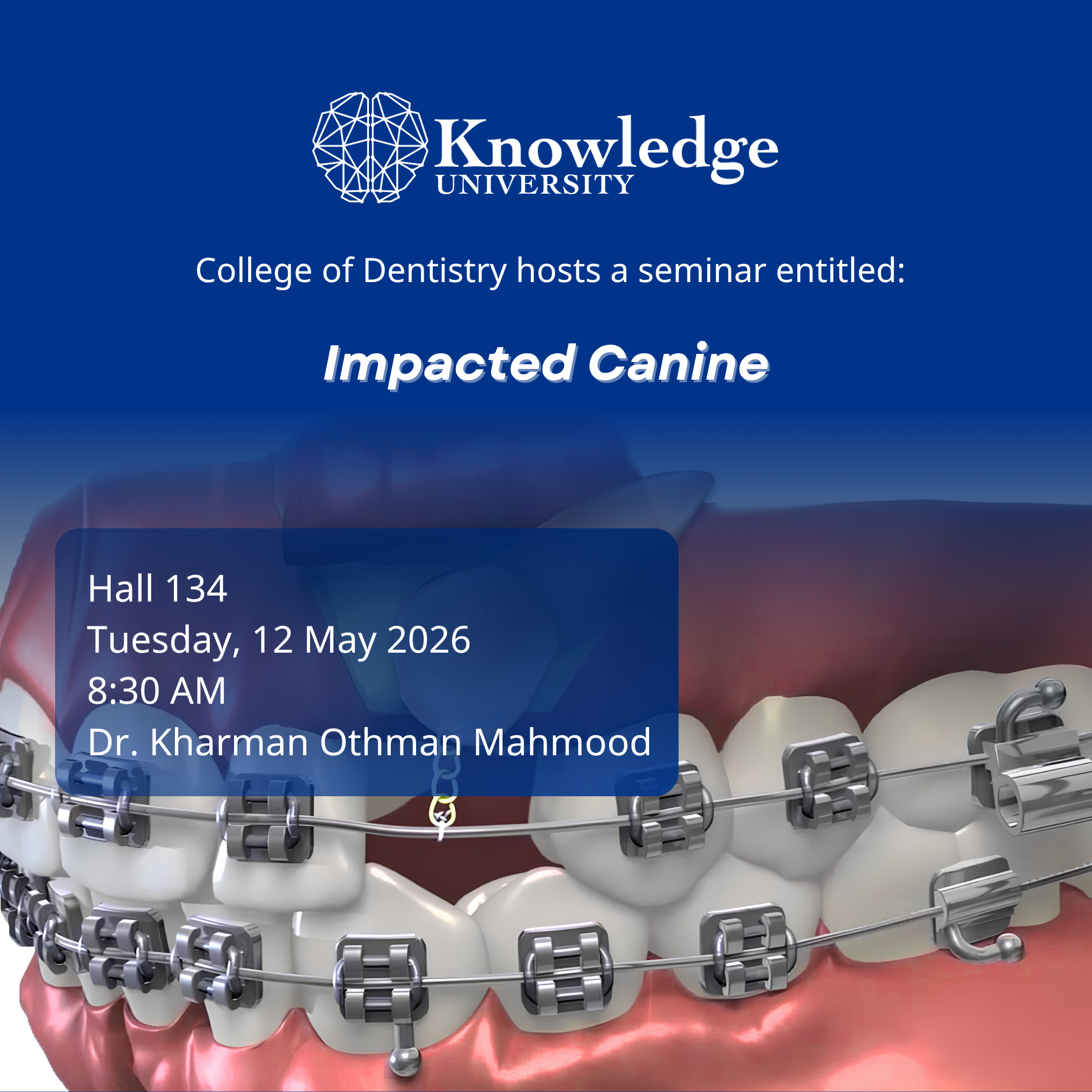 Impacted Canine