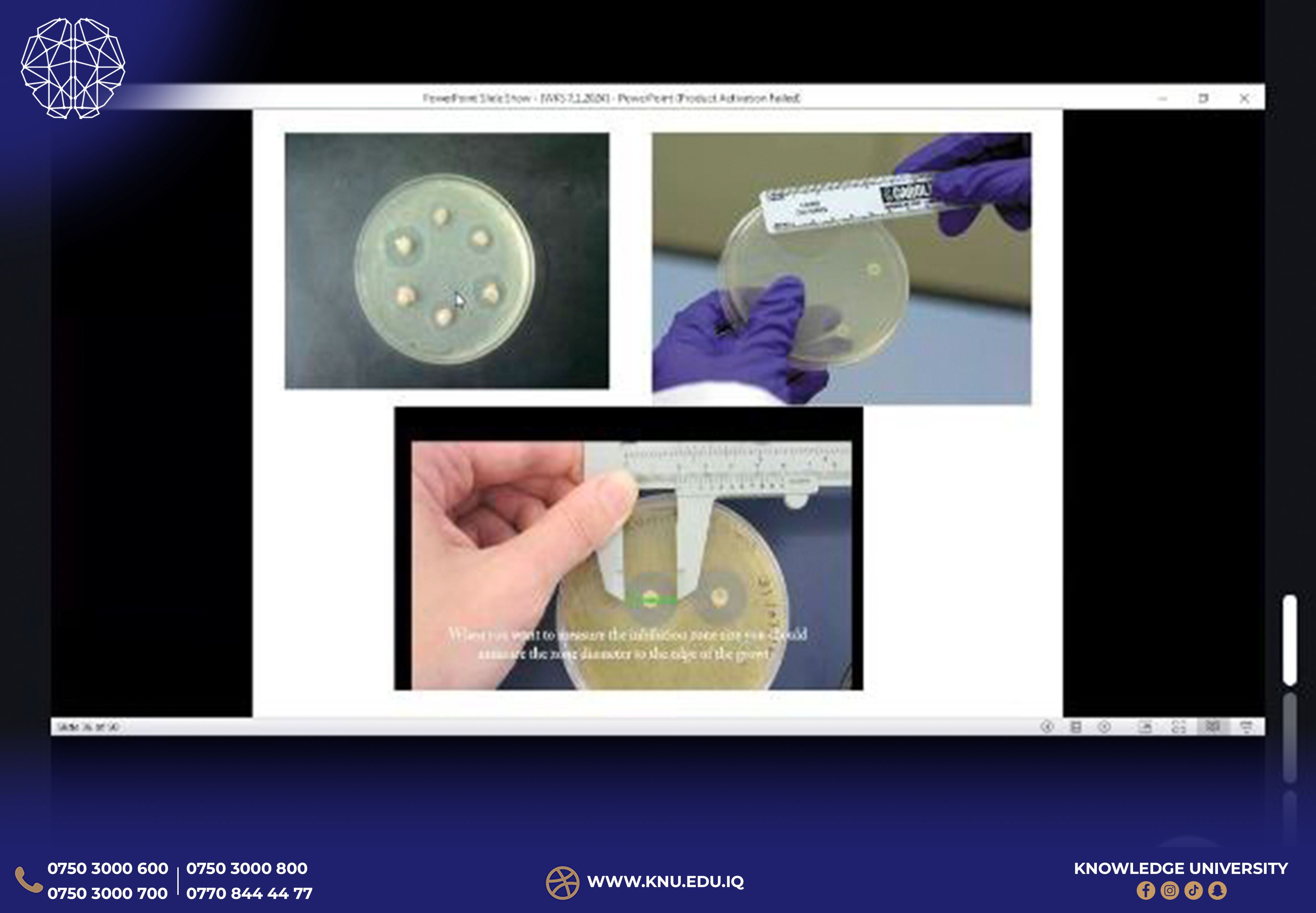 Medical Laboratory Science Hosts Online Workshop on Systemic Fungi and Their Impact on Human Physiology